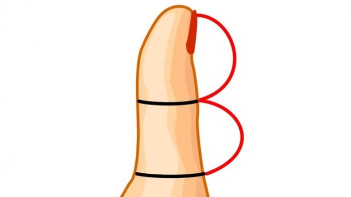 ,