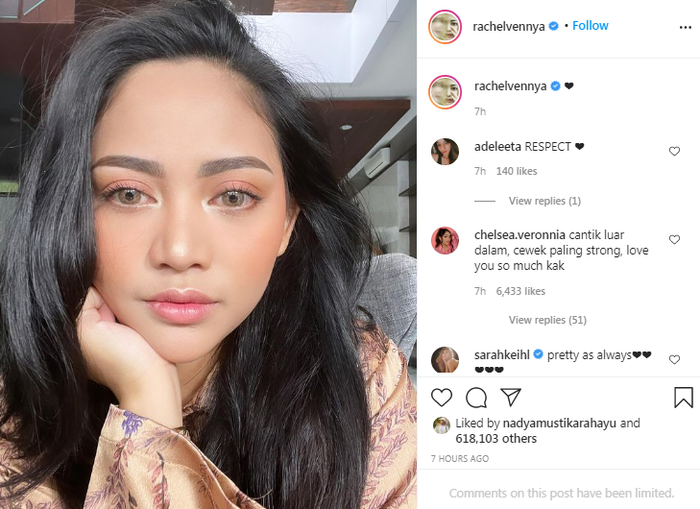Rachel Vennya unggah foto tanpa hijab.