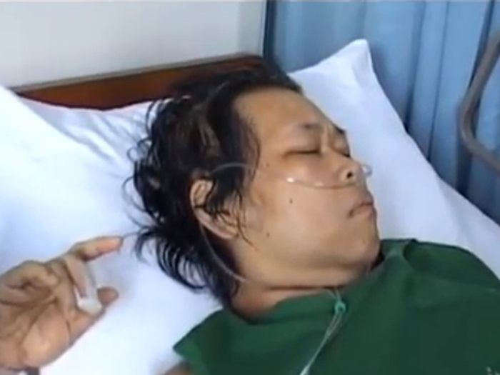 Rini S Bon Bon hampir saja kehilangan kaki