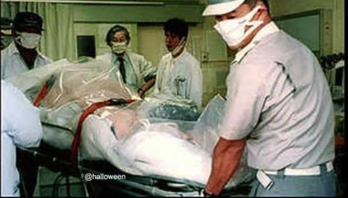 Ilustrasi - Hisashi Ouchi  sedang ditangani tim medis.