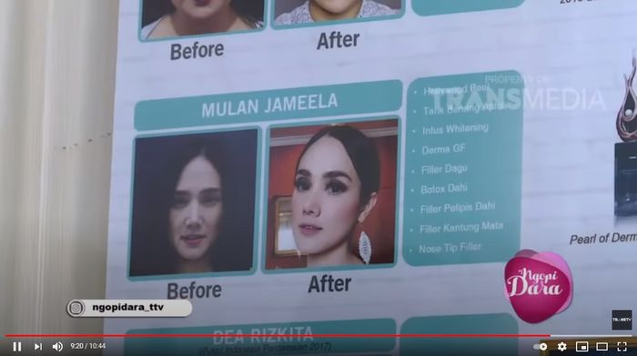 Nia Ramadhani bongkar perawatan wajah Mulan Jameela