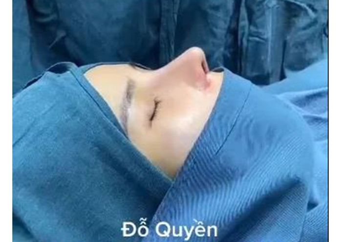 Pria yang rela operasi 9 kali, sekarang penampilannya bikin pangling! <a href='https://manado.tribunnews.com/tag/tiktok' title='TikTok'>TikTok</a> via World of Buzz