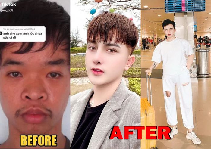 Pria yang rela operasi 9 kali, sekarang penampilannya bikin pangling! 
