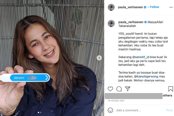 Padahal Istrinya Baru Saja Umumkan Kehamilan, Baim Wong Kaget Tahu Usia