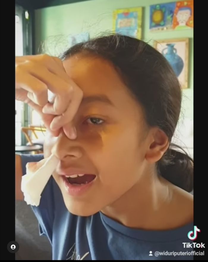 Widuri Putri Sasono mempraktikan posisi kepala yang benar saat mengalami mimisan.