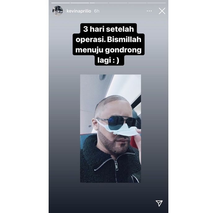 Lakukan Transplantasi Rambut di Turki, Penampilan Terbaru ...