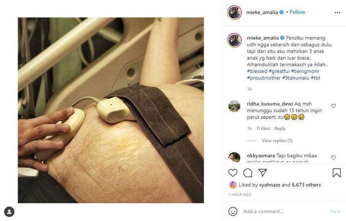 Mieke Amalia Unggah Foto Perut Buncitnya Saat Hamil