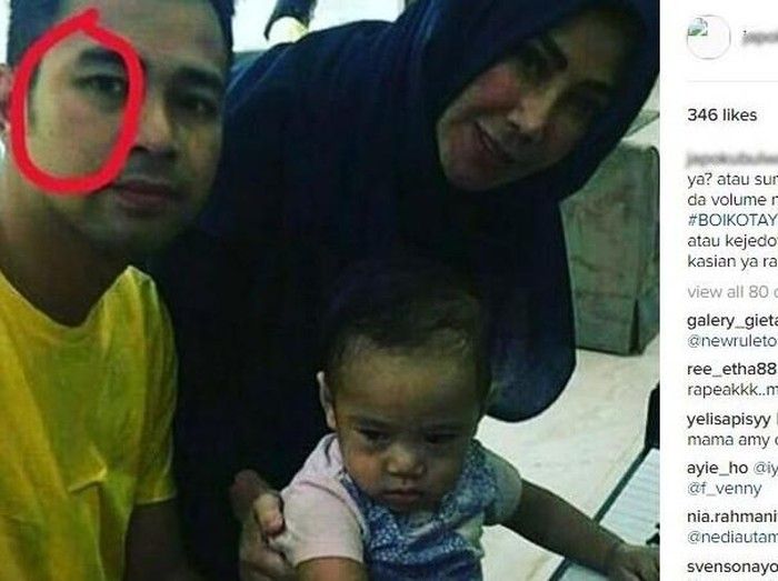 Raffi Ahmad's swollen face was allegedly punched by Caca Tengker