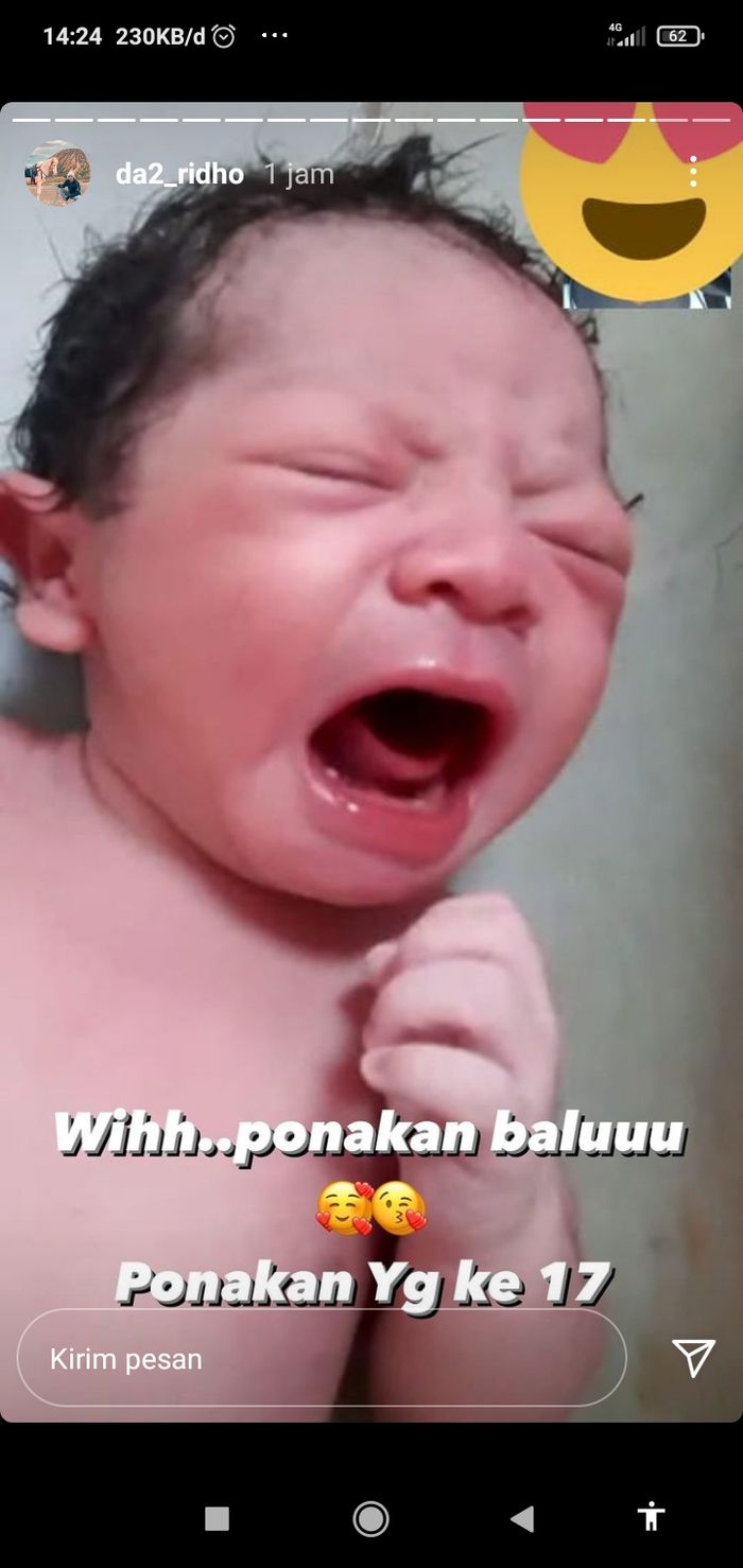 Nadya Mustika Rahayu Terpapar Covid-19 Sebelum Melahirkan Anak