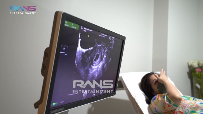 Nagita Slavina tak kuasa menahan harunya saat melihat hasil USG