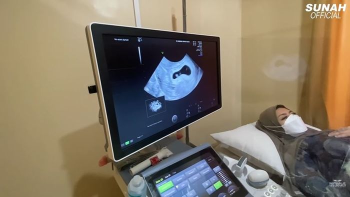 Nathalie Holscher sedang melakukan USG di <a href='https://tribunmedan.cfd/tag/rumah-sakit' title='rumah&nbsp;sakit'>rumah&nbsp;sakit</a>.