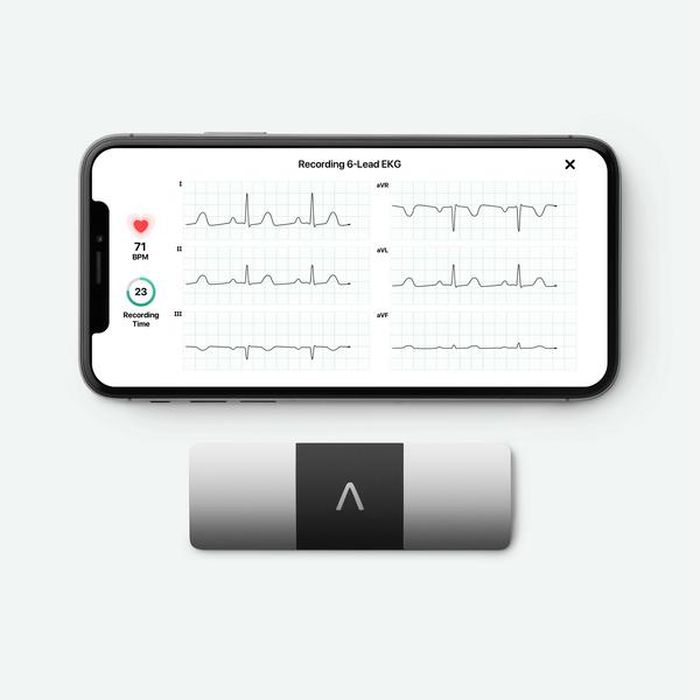 ECG Apple Watch Langgar Hak Paten 