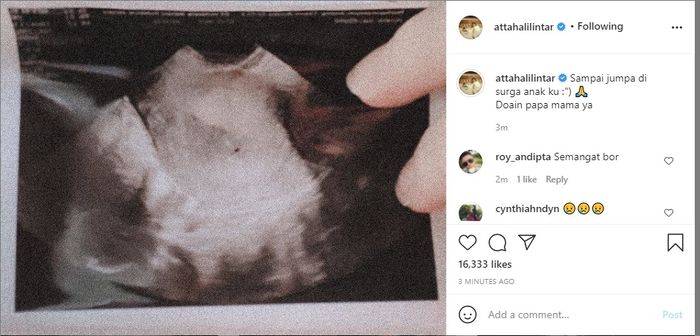 Aurel keguguran, Atta tulis pesan perpisahan untuk anaknya