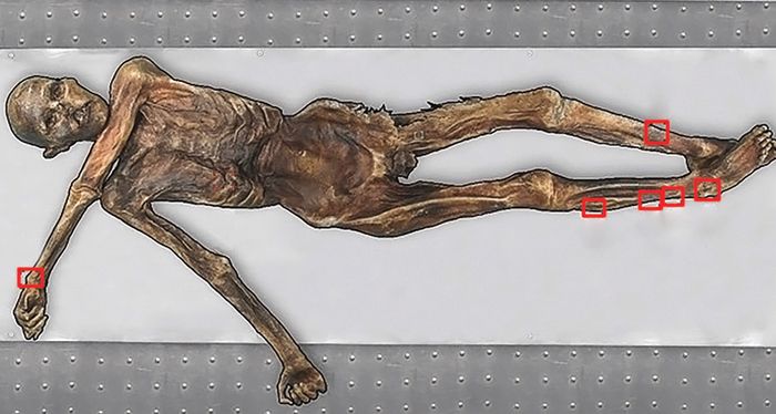 Ötzi the Iceman, pemilik tato tertua. Namun, peneliti belum menemukan alat tato yang digunakan.