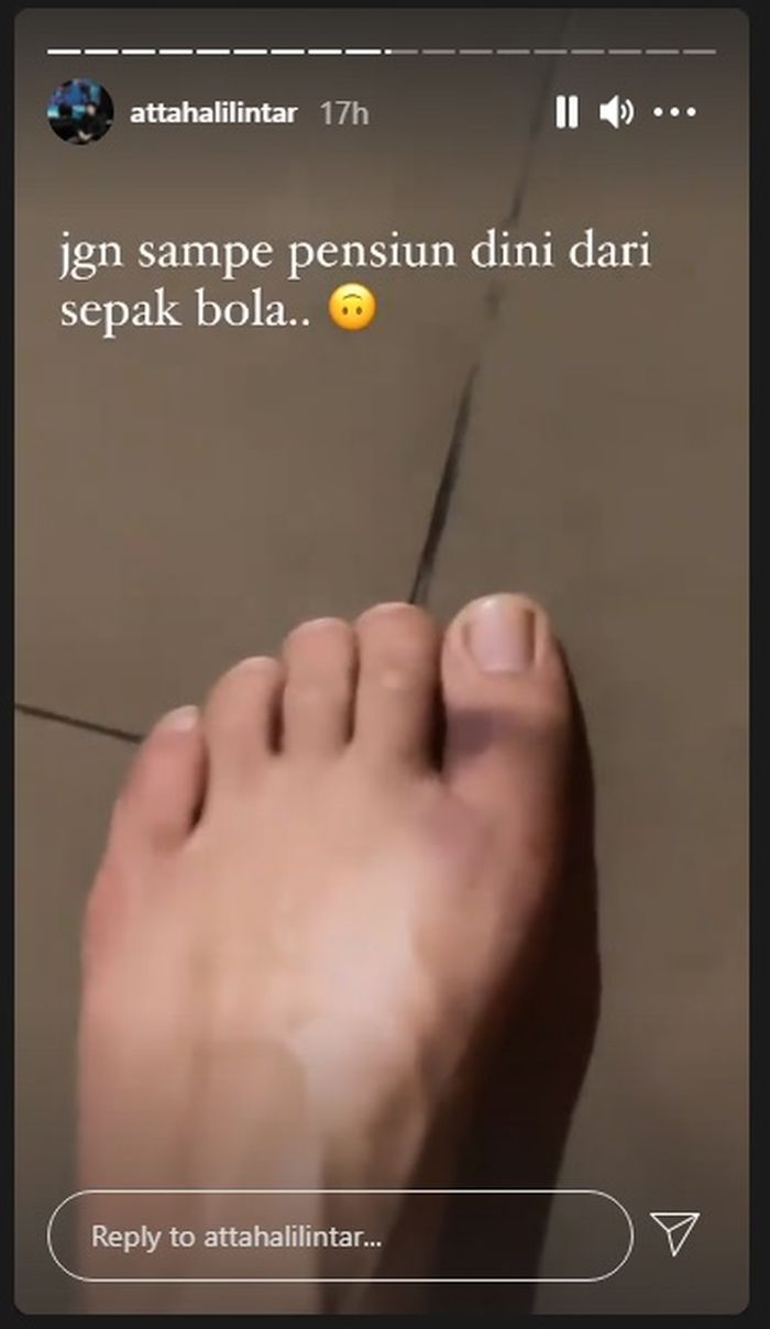 Kondisi kaki Atta Halilintar