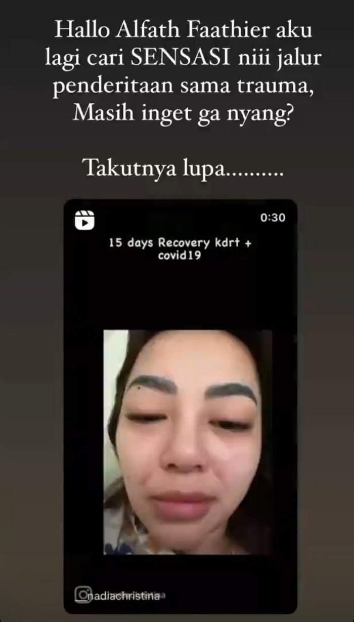 Nadia Christina membeberkan bukti KDRT yang dilakukan Alfath Fathier.