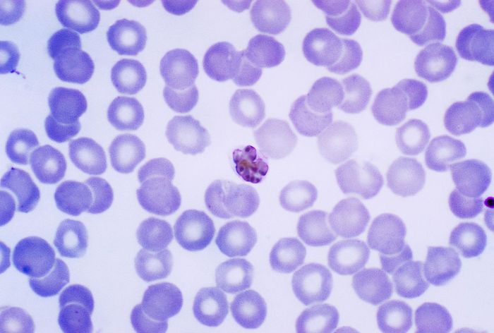 1200px-mature_plasmodium_malaria-20210803013617