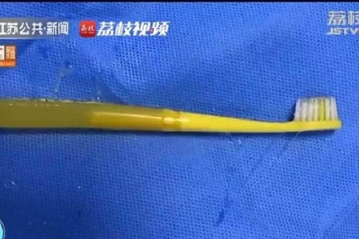 Sikat gigi yang ditelan seorang pria di Provinsi Jiangsu, China.
