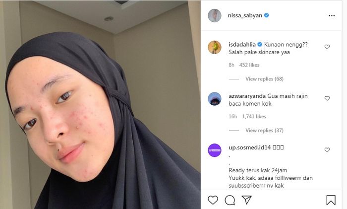 Iis Dahlia komentari wajah tak mulus Nissa Sabyan.