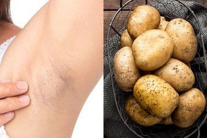 Gunakan kentang untuk mengatasi ketiak hitam dan rasakan khasiatnya
