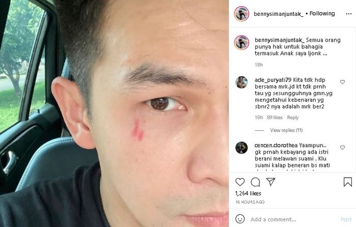 Unggahan Benny Simanjuntak usai Jonathan Frizzy disebut buka peluang rujuk dengan Dhena Devanka.Tangkap layar Instagram @bennysimanjuntak_
