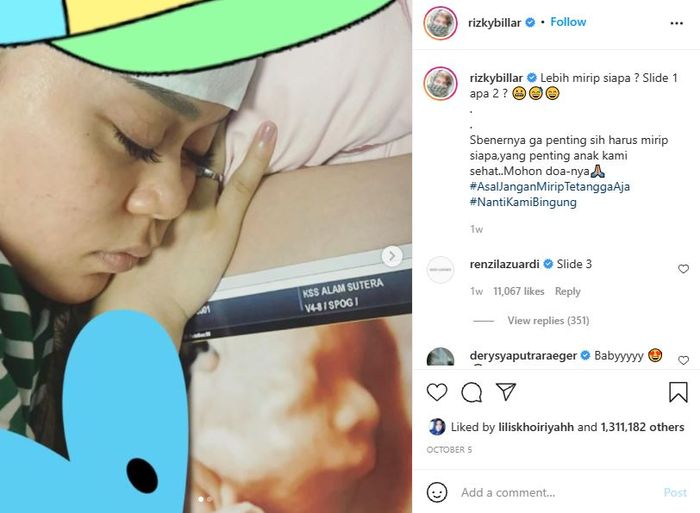 Hasil USG anak pertama Rizky Billar dan Lesti Kejora
