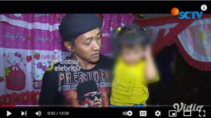 Teddy Pardiyana lebih kurus dari biasanya