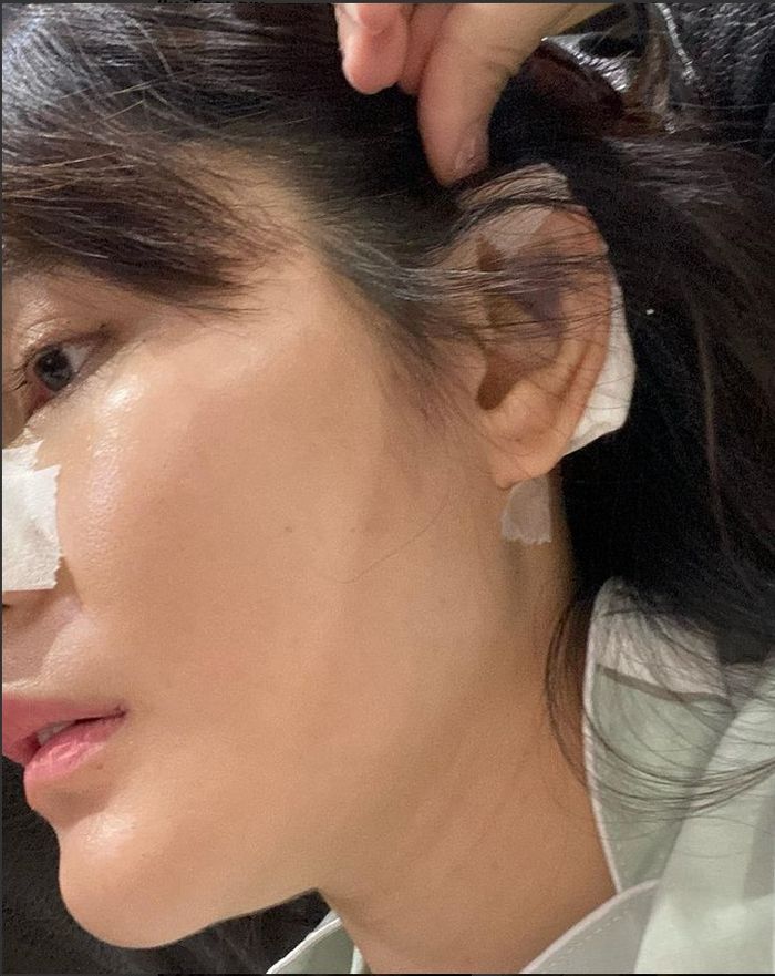 Angela Lee sedang merasakan kegagalan operasi hidung.