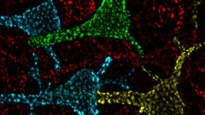 Los científicos del Laboratorio Trimmer de la Facultad de Medicina de UC Davis han descubierto una proteína misteriosa que se encuentra en las neuronas. 
