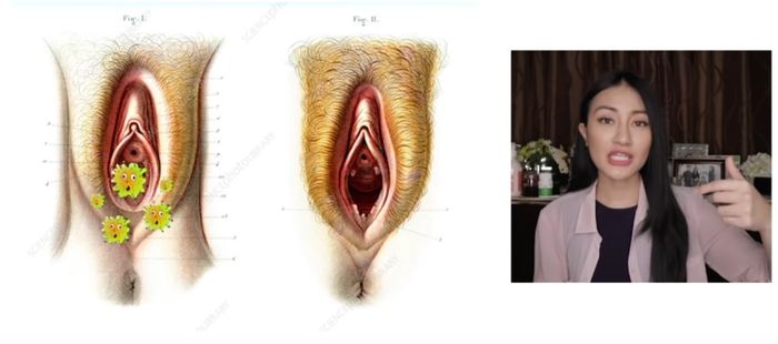 Dokter clarin hayes saat menjelaskan kebiasaan yang salah yang banyak dilakukan perempuan saat menstruasi.