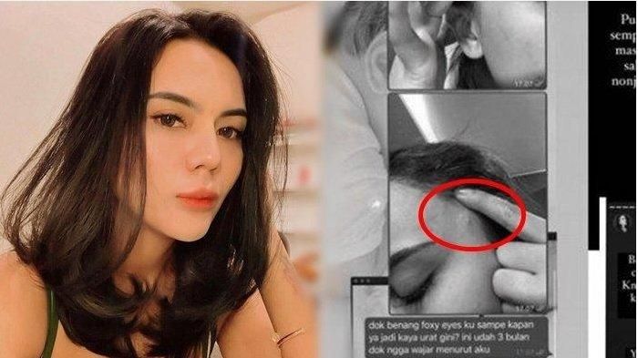 Kondisi Anggita Sari