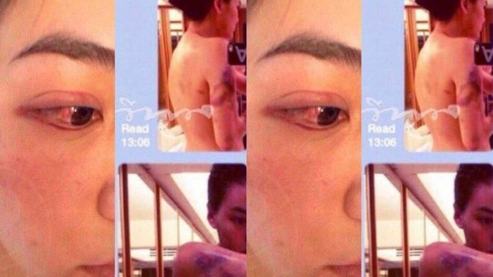 Janie Tienphosuwan alami KDRT oleh suaminya