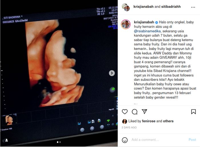 Akhirnya perdana pajang cajah calon bayi, Krisjiana Baharudin kini pampang foto USG anak pertamanya dengan Siti Badriah.