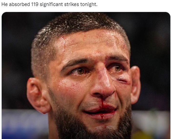 Penampakan wajah Khamzat Chimaev setelah pertarungan brutal melawan Gilbert Burns di UFC 273, Minggu (10/4/2022) di Jacksonville, Amerika Serikat.