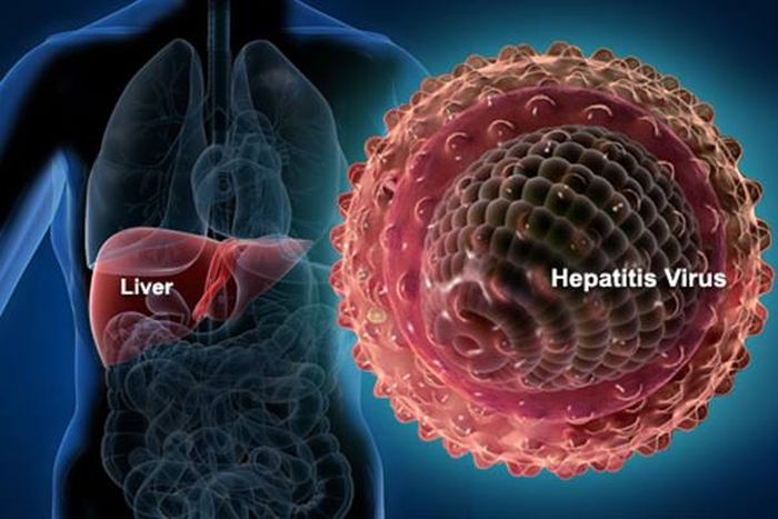 Hepatitis akut misterius sudah dinyatakan KLB oleh WHO. Sudah memakan 3 korban usia anak di Indonesia.