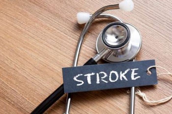 Cegah stroke dari usia muda