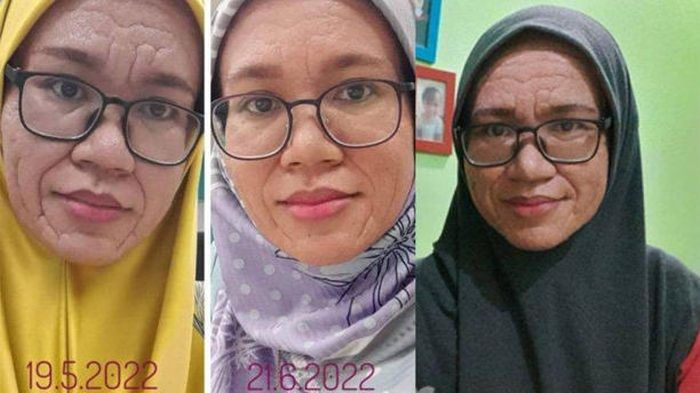 Lyna Sabran setelah melahirkan anak ketiga berubah menjadi nenek-nenek, padahal usianya baru 37 tahun