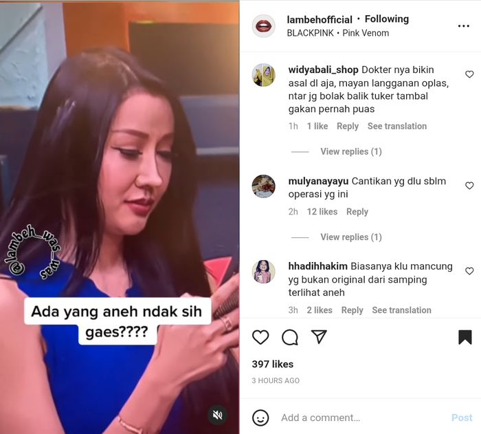 Wajah Lucinta Luna disorot setelah operasi plastik.