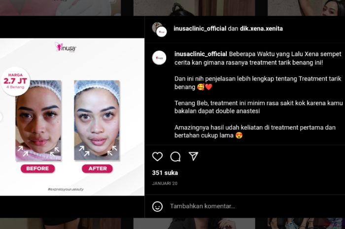 Xena Xeni jadi BA