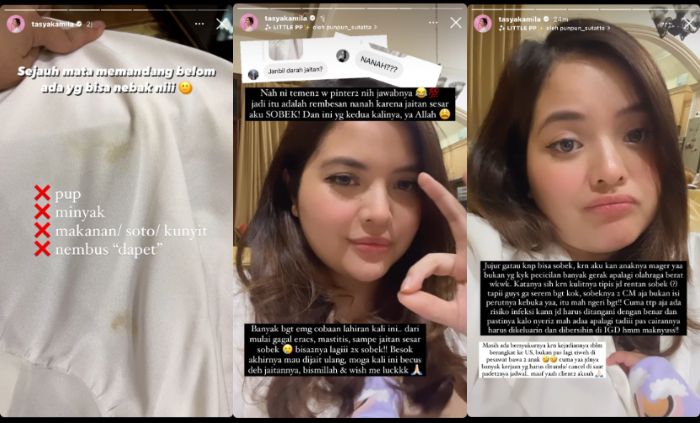 Cerita Tasya Kamila saat jahitan sobek