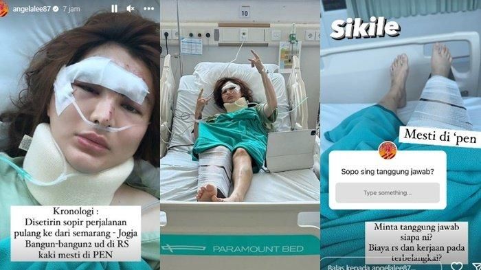 Angela Lee alami kecelakaan mobil