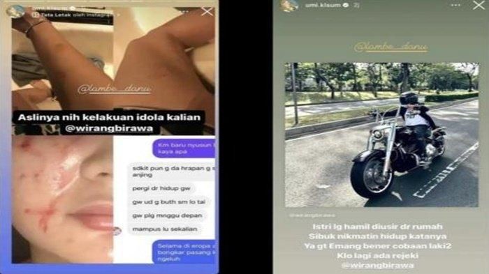 Istri Wirang Birawa tunjukkan bukti lebam-lebam