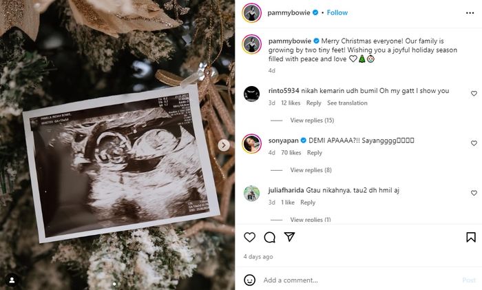 Pamela Bowie saat umumkan hamil anak pertama.