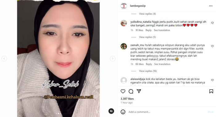 Cita Citata Akui Kena Penyakit Autoimun Gegara Suntik Vitamin C Demi Hal Ini: Kesalahan Aku...