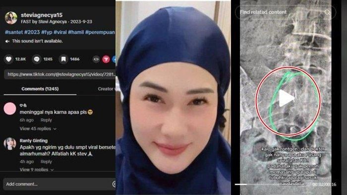 Penyebab Stevie Agnecya meninggal dunia belum terungkap, namun sebelum hembuskan nafas terakhir, ia sempat menunjukkan hasil rontgen.