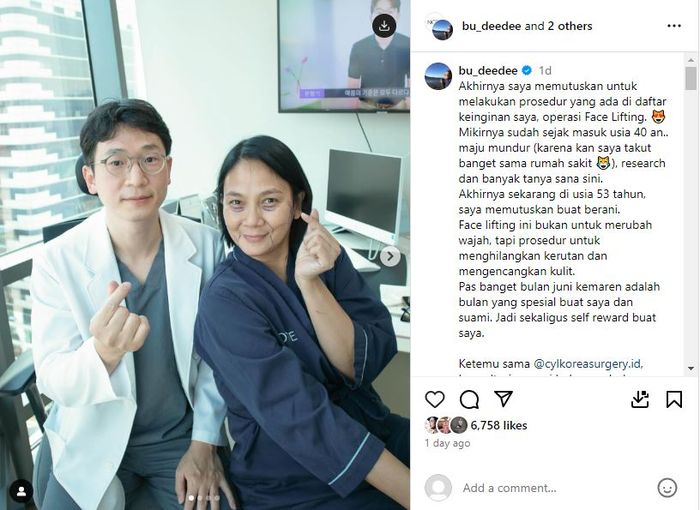 Penampilan Dian Nitami sebelum melakukan operasi wajah