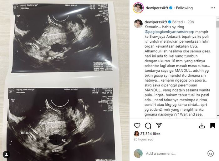 Unggahan Dewi Perssik