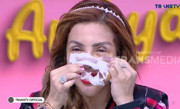 Barbie Kumalasari membuka perban yang menutupi area wajahnya.