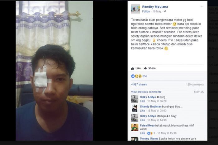 Rendhy pernah terkena abu rokok