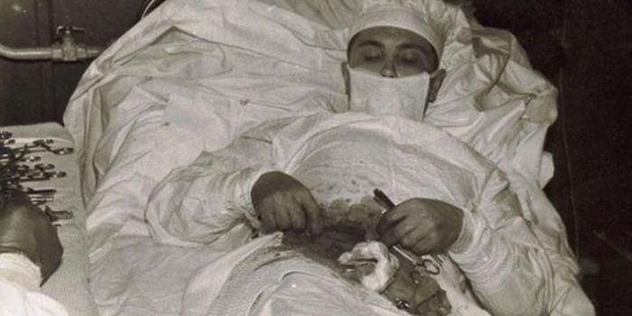 Leonid Ivanovich Rogozov mengoperasi dirinya sendiri.